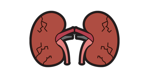 Enfermedad Renal Crónica 4242